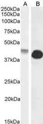 Anti-Connexin 43 antibody, Internal used in Western Blot (WB). GTX88424
