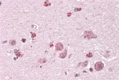 Anti-CHN2 antibody, C-term used in IHC (Paraffin sections) (IHC-P). GTX88448