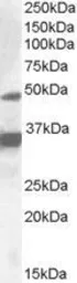 Anti-PXR antibody, Internal used in Western Blot (WB). GTX88474