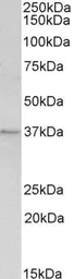 Anti-Annexin A1 antibody, C-term used in Western Blot (WB). GTX88476