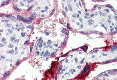 Anti-Annexin A1 antibody, C-term used in IHC (Paraffin sections) (IHC-P). GTX88476