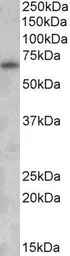 Anti-GAD67 antibody, Internal used in Western Blot (WB). GTX88492