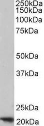 Anti-Ferritin Heavy chain antibody, C-term used in Western Blot (WB). GTX88497