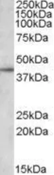 Anti-Apolipoprotein L3 antibody, C-term used in Western Blot (WB). GTX88512