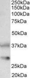 Anti-Clusterin antibody, C-term used in Western Blot (WB). GTX88520