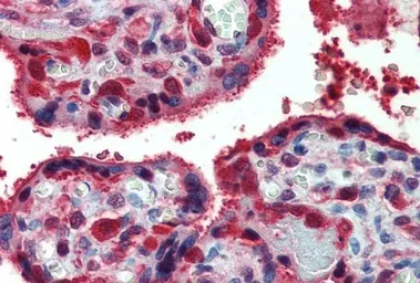 Anti-PRX I antibody, Internal used in IHC (Paraffin sections) (IHC-P). GTX88526