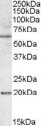 Anti-SODD antibody, Internal used in Western Blot (WB). GTX88531