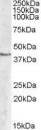Anti-SPHK1 antibody, Internal used in Western Blot (WB). GTX88593