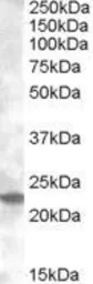 Anti-RAB17 antibody, Internal used in Western Blot (WB). GTX88622