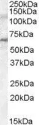 Anti-IRAK3 antibody, Internal used in Western Blot (WB). GTX88632