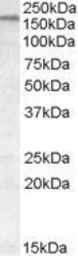 Anti-ABCA9 antibody, Internal used in Western Blot (WB). GTX88709