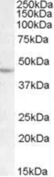 Anti-LHX2 antibody, C-term used in Western Blot (WB). GTX88731