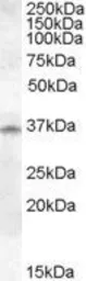 Anti-Cathepsin K antibody, Internal (near N-term) used in Western Blot (WB). GTX88744
