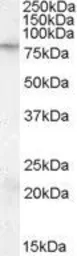Anti-FMRP antibody, Internal used in Western Blot (WB). GTX88748