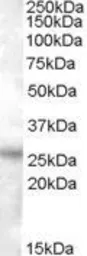 Anti-RASSF3 antibody, C-term used in Western Blot (WB). GTX88778