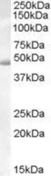 Anti-ACTL7B antibody, Internal used in Western Blot (WB). GTX88858