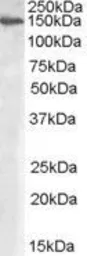 Anti-MAN2A1 antibody, Internal used in Western Blot (WB). GTX88874