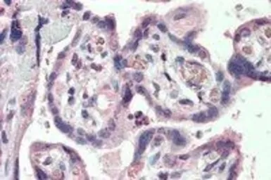 Anti-SLC12A4 antibody, Internal used in IHC (Paraffin sections) (IHC-P). GTX88934