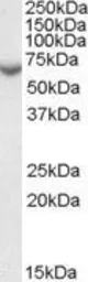 Anti-Steroid sulfatase antibody, Internal used in Western Blot (WB). GTX88935