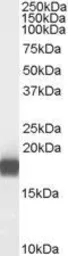 Anti-PLA2G1B antibody, C-term used in Western Blot (WB). GTX88948
