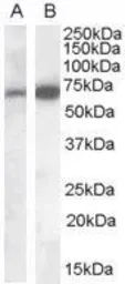 Anti-CADM4 antibody, Internal used in Western Blot (WB). GTX88956