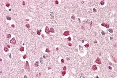 Anti-GRIK1 antibody, Internal used in IHC (Paraffin sections) (IHC-P). GTX88972