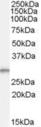 Anti-TPD52L2 antibody, C-term used in Western Blot (WB). GTX88975