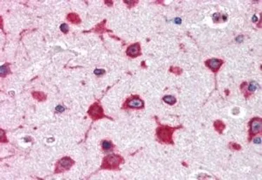 Anti-RPL8 antibody, Internal used in IHC (Paraffin sections) (IHC-P). GTX88990