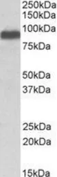 Anti-ITCH antibody, Internal used in Western Blot (WB). GTX88991