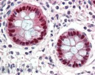 Anti-EGR2 antibody, Internal used in IHC (Paraffin sections) (IHC-P). GTX88998