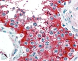 Anti-G6PD (aa 308 - 320) antibody, Internal used in IHC (Paraffin sections) (IHC-P). GTX89057