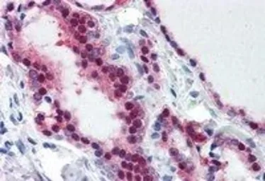 Anti-TIA1 antibody, Internal used in IHC (Paraffin sections) (IHC-P). GTX89059