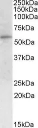 Anti-G6PD (aa 305 - 318) antibody, Internal used in Western Blot (WB). GTX89073
