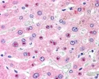 Anti-C14orf68 antibody, Internal used in IHC (Paraffin sections) (IHC-P). GTX89144