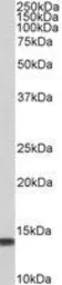 Anti-S100A4 antibody, C-term used in Western Blot (WB). GTX89197