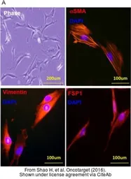 Anti-S100A4 antibody, C-term used in Immunocytochemistry/ Immunofluorescence (ICC/IF). GTX89197