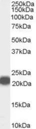Anti-RKIP antibody, Internal used in Western Blot (WB). GTX89220