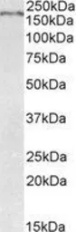 Anti-ROBO1 antibody, Internal used in Western Blot (WB). GTX89225