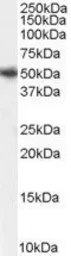 Anti-PICK1 antibody, Internal used in Western Blot (WB). GTX89265