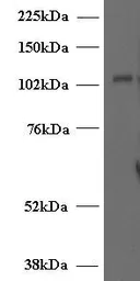 Anti-Munc 13-4 antibody, Internal used in Western Blot (WB). GTX89269