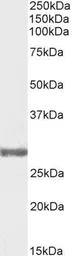 Anti-COMT antibody, Internal used in Western Blot (WB). GTX89277