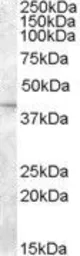 Anti-SLC24A5 antibody, Internal used in Western Blot (WB). GTX89312