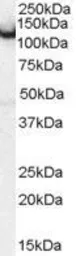 Anti-Amphiphysin antibody, Internal used in Western Blot (WB). GTX89317