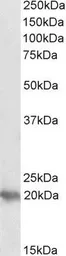Anti-PERP antibody, C-term used in Western Blot (WB). GTX89344