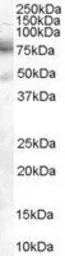 Anti-DCP1A antibody, C-term used in Western Blot (WB). GTX89354