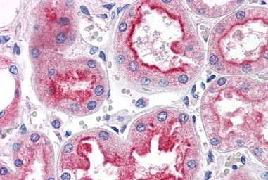 Anti-SMAD9 antibody, Internal used in IHC (Paraffin sections) (IHC-P). GTX89360