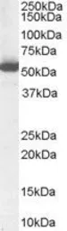 Anti-ALDH1A1 antibody, Internal used in Western Blot (WB). GTX89404