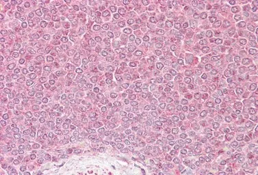 Anti-VPS45 antibody, Internal used in IHC (Paraffin sections) (IHC-P). GTX89447