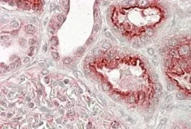 Anti-VPS11 antibody, Internal used in IHC (Paraffin sections) (IHC-P). GTX89450