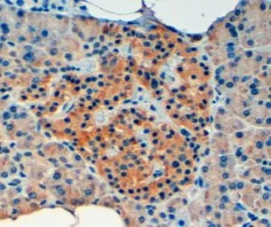 Anti-VPS11 antibody, Internal used in IHC (Paraffin sections) (IHC-P). GTX89450